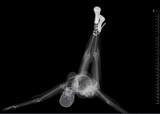 Illustration for article titled X-Ray Console Quiz!